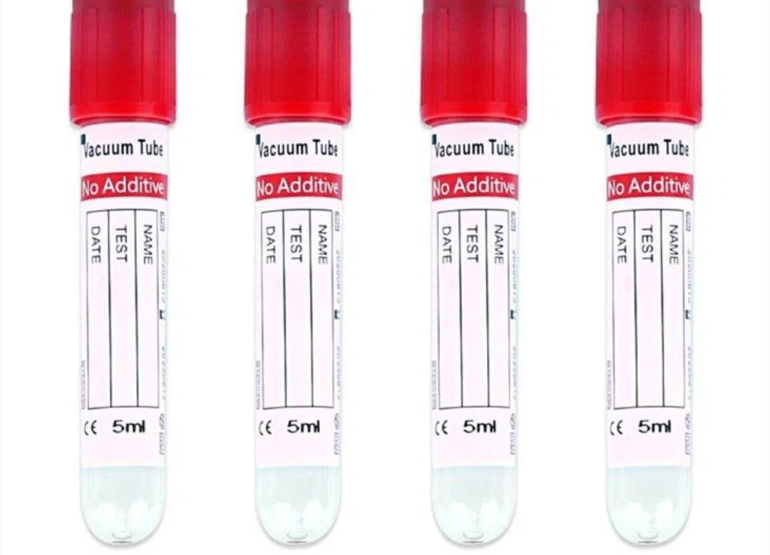 Vacutainer Σωληνάρια αιμοληψίας κόκκινο 5ml, 13x75mm (100 τεμάχια)